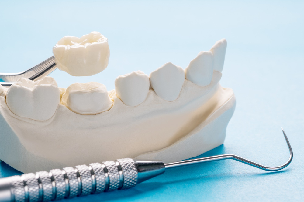 closeup-prosthodontics-or-prosthetic-single-teeth-crown-and-bridge-equipment-model-express-fix-restoration-1.jpeg